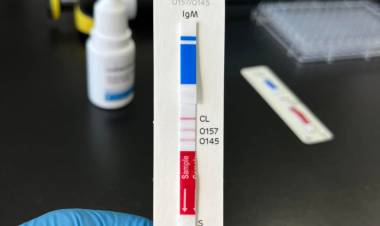 Cómo es el revolucionario test que detecta el síndrome urémico hemolítico en 10 minutos