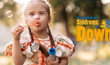 Síndrome de Down