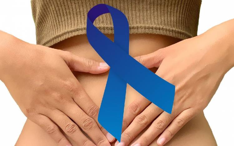 Cáncer de Colon. Las cosas por su nombre
